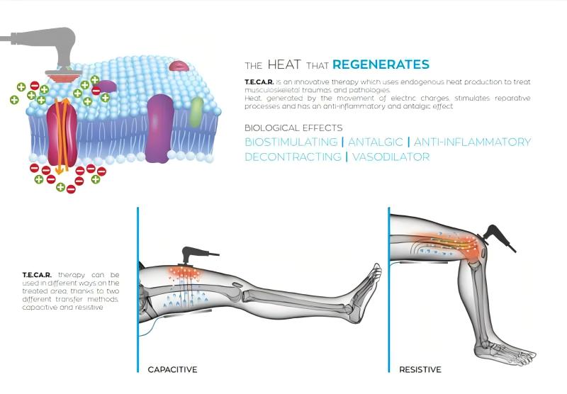 3 in 1 shockwave tecar therapy machine