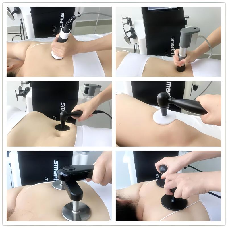 3 in 1 shockwave tecar therapy machine