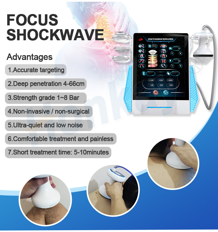 focus shockwave