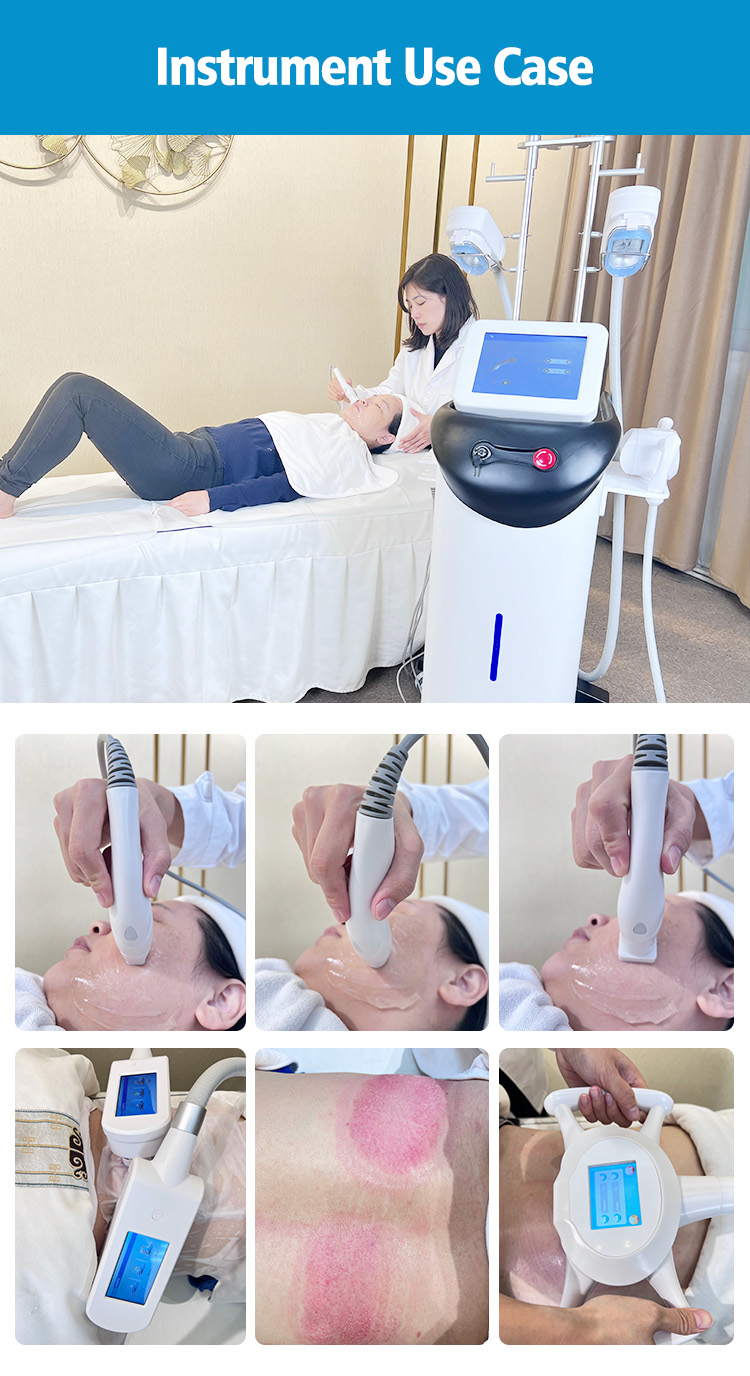 Fat freezing machine slimming machine