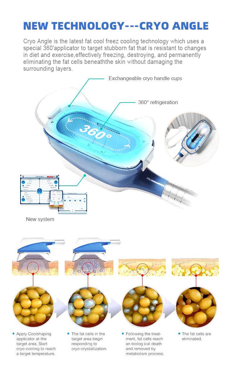 fat freeze lose weight