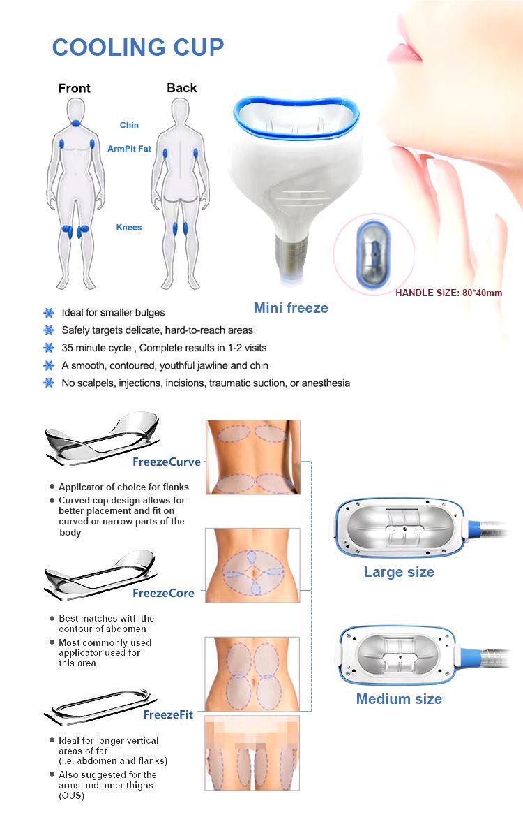 fat freeze lose weight