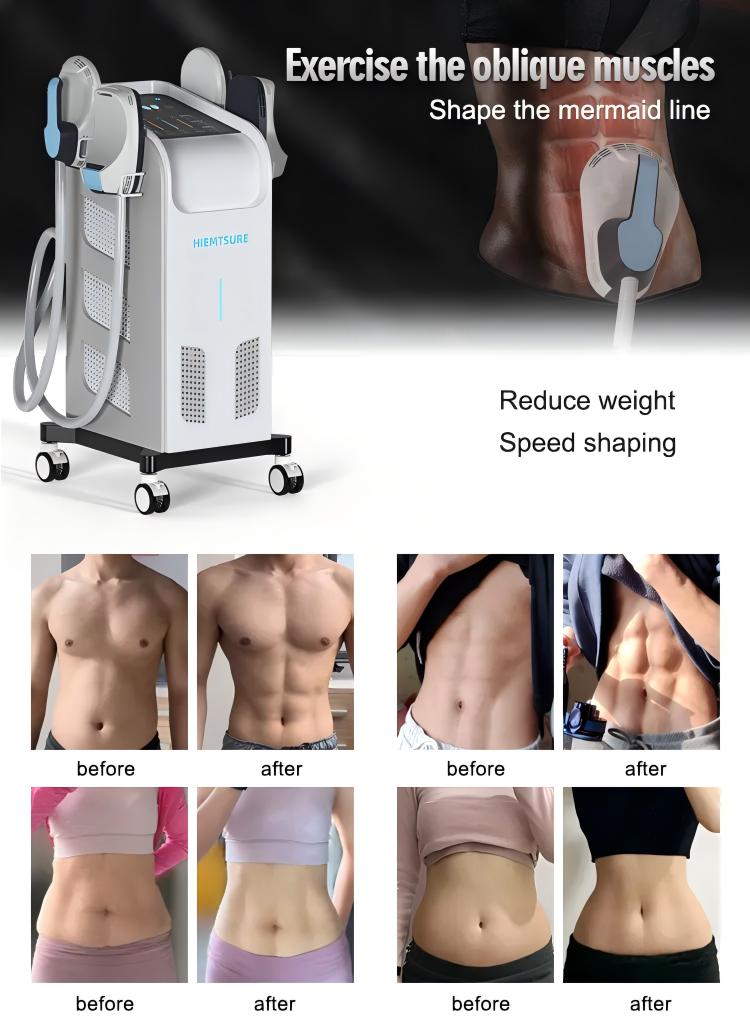 body sculpting machine