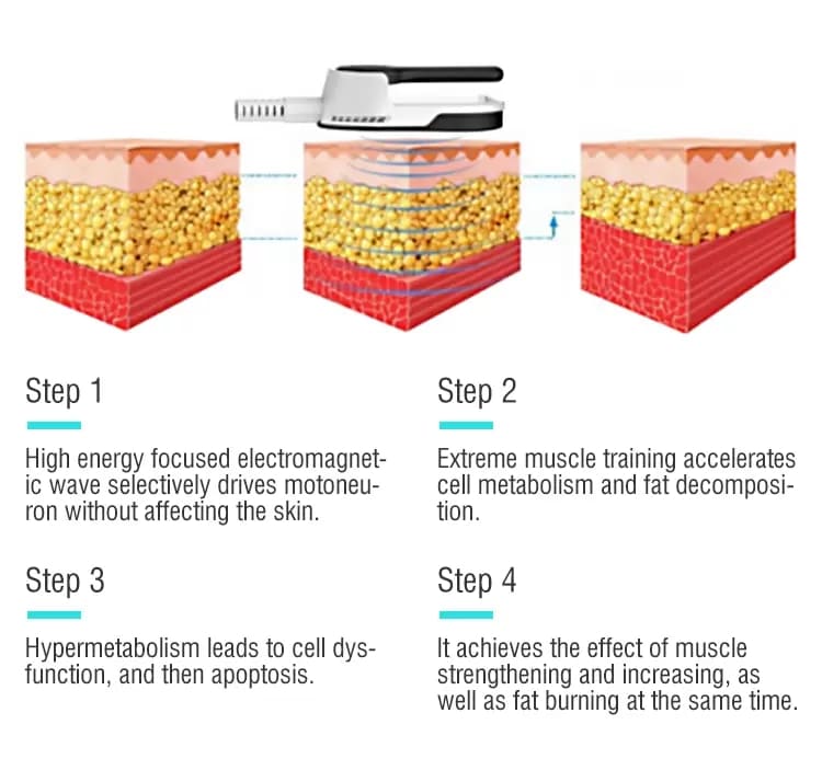 body sculpting machine