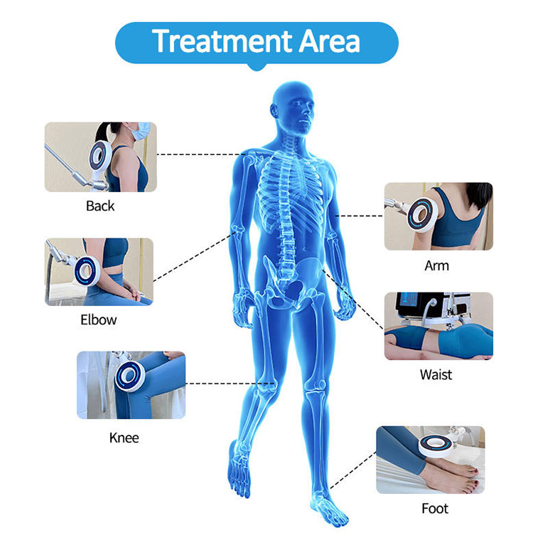 physio magneto therapy