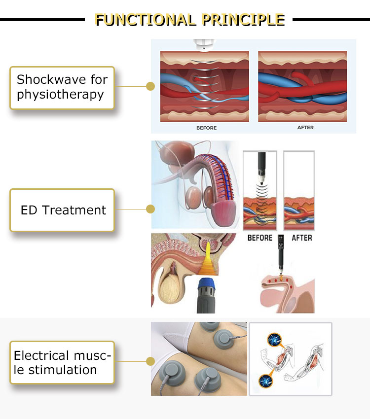 ed shockwave therapy machines for sale