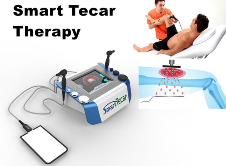 smart tecar pro