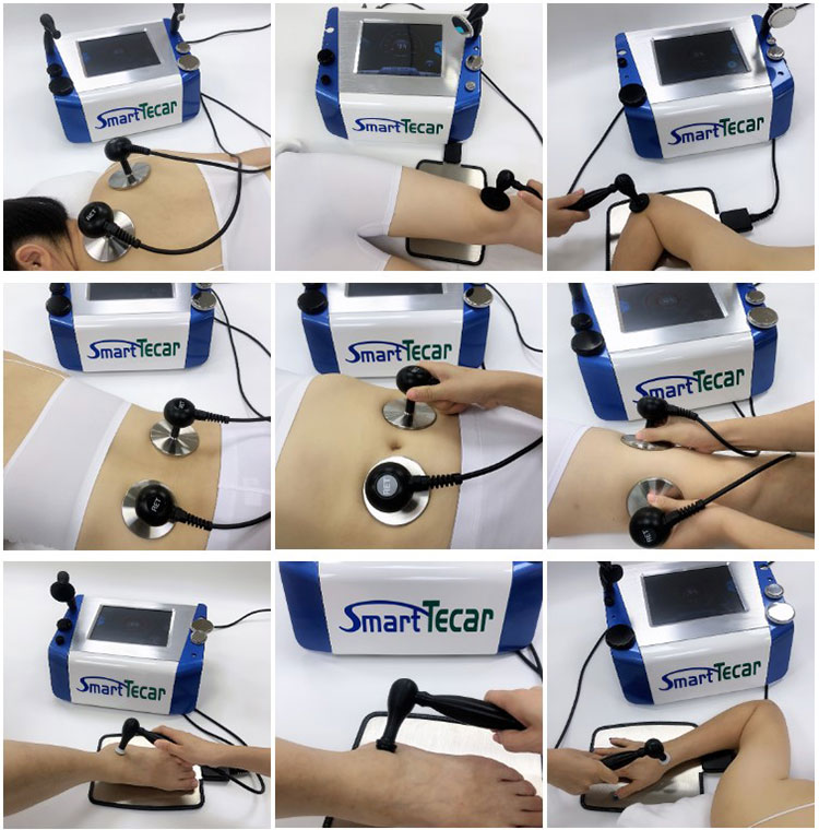 tecar therapy hyperthermia for body care machine