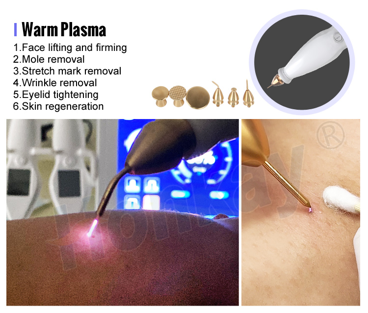 cold plasma pen