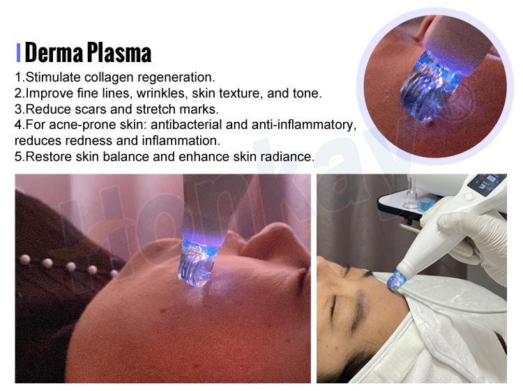 cold plasma pen