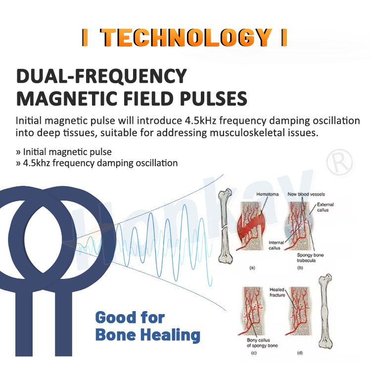 physio magnetic therapy